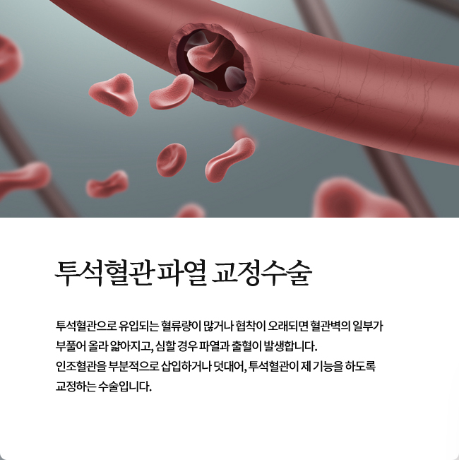 투석혈관파열 교정수술