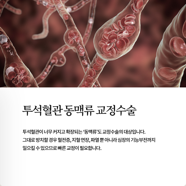 투석혈관 동맥류 교정수술