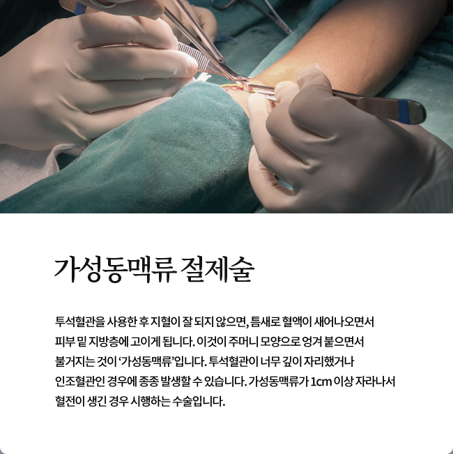 가성동맥류 절제술