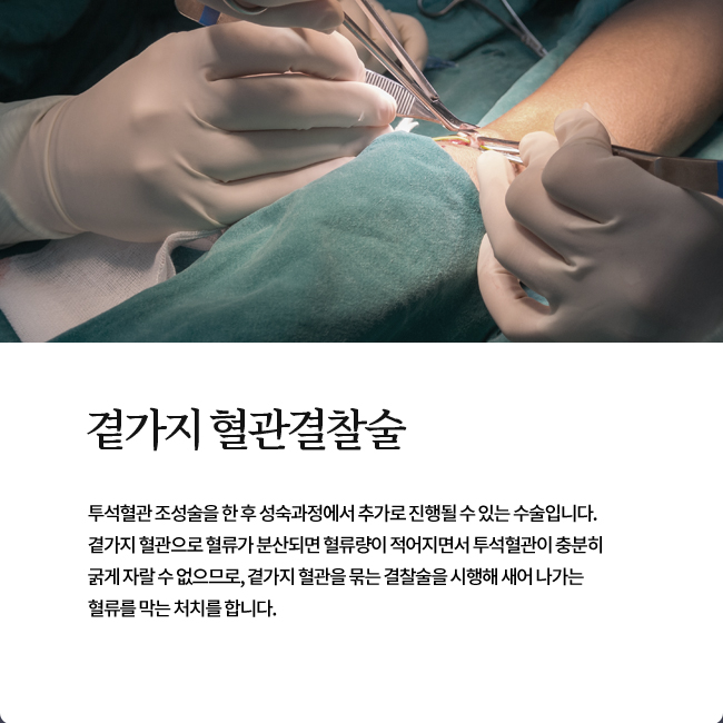 곁가지 혈관결찰술