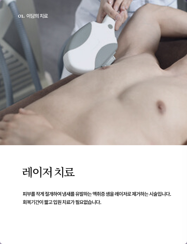 레이저치료