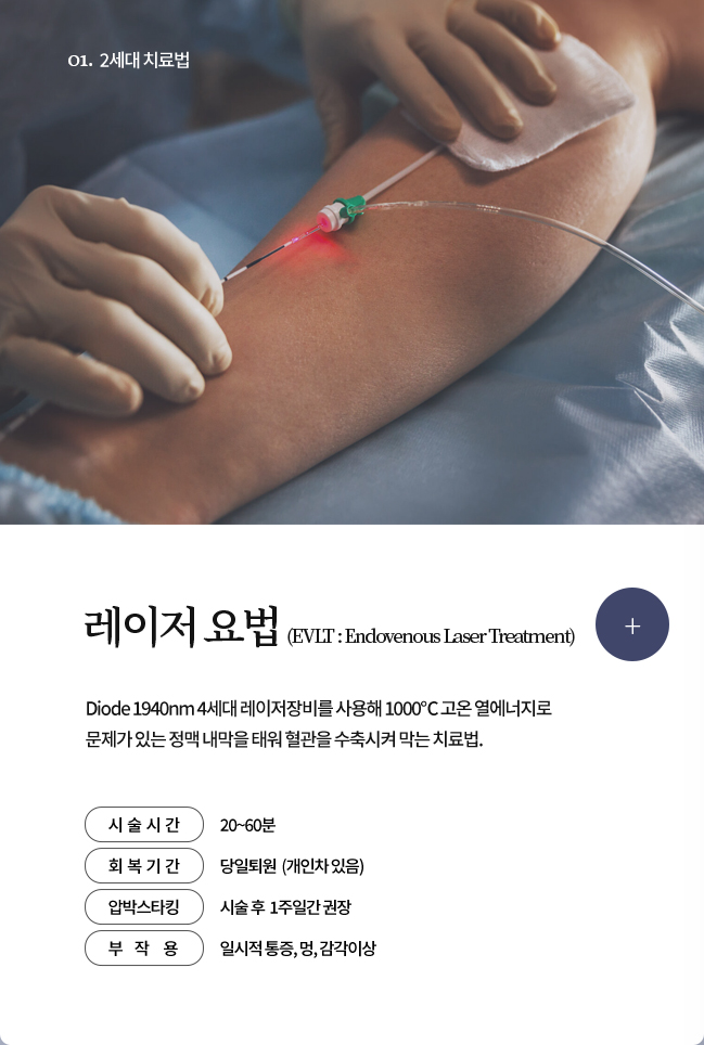 레이저 요법 (EVLT : Endovenous Laser Treatment)